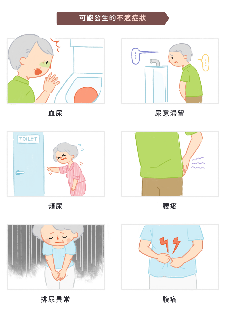 腎結石常見症狀:血尿、頻尿、排尿異常、尿意滯留、腰痠、腹痛等現象