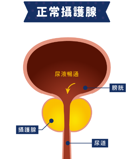 正常攝護腺 - 圖示